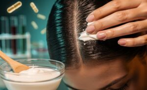 Illustration of the yogurt remedy for scalp health and how probiotics balance pH